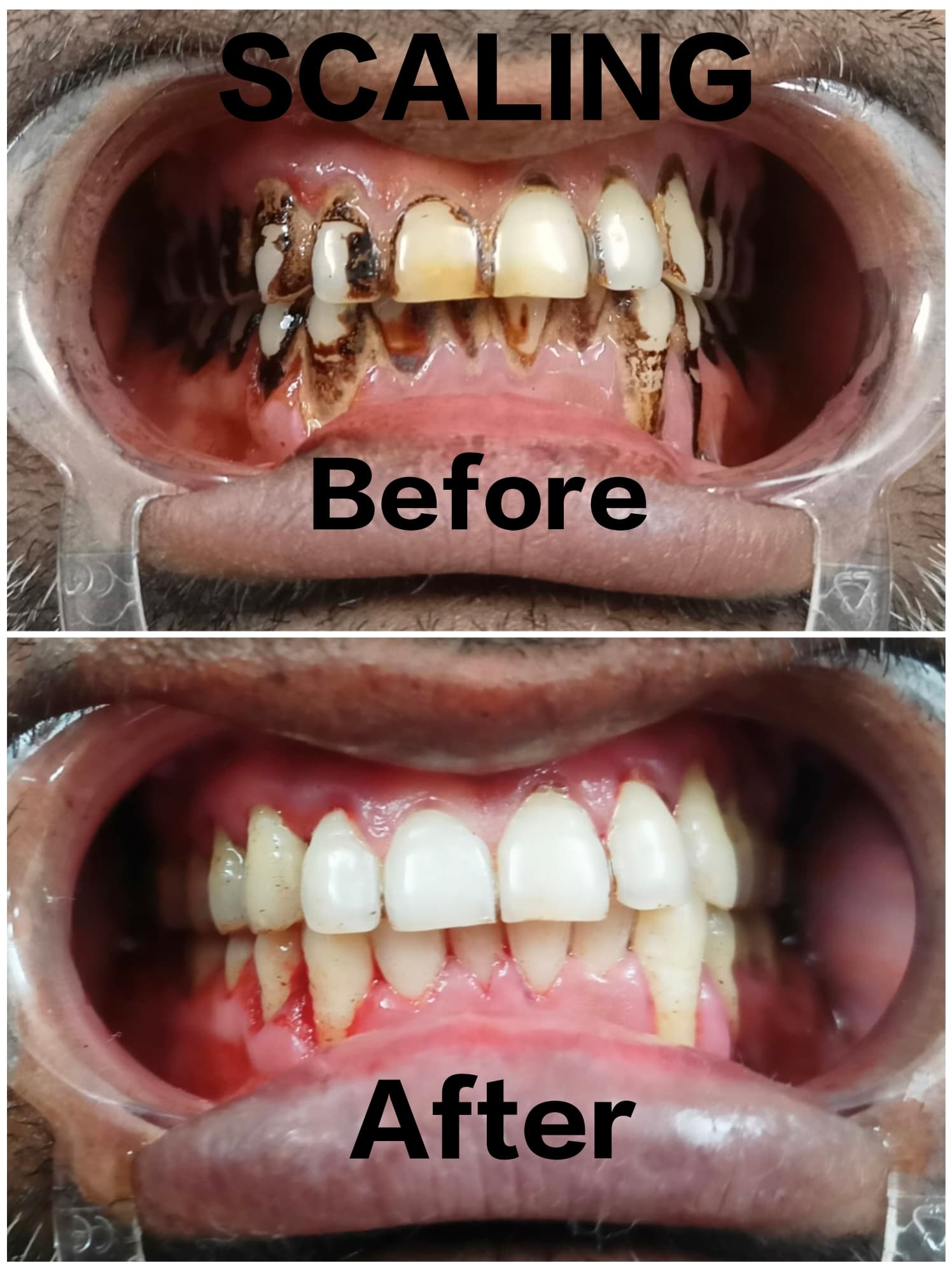 Professional Cleaning Results